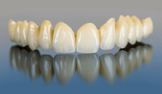 dental-crown-bridges